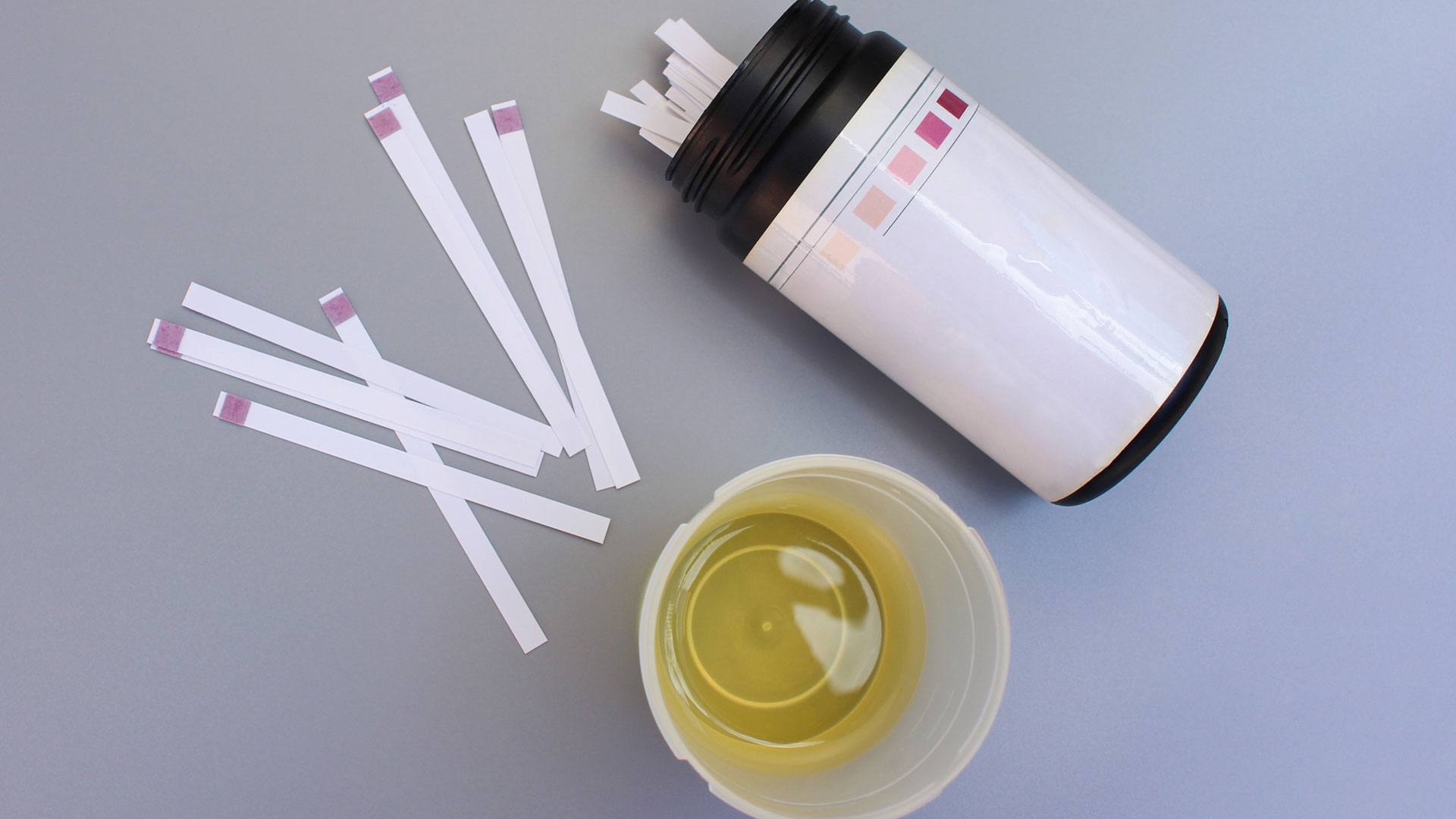 Urine test strips indicate whether or not your body is in ketosis.